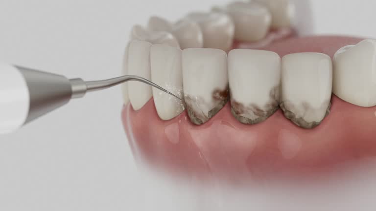 Reliable Dental Implants contractor in Fisher, IL by Smile Center Dentistry
